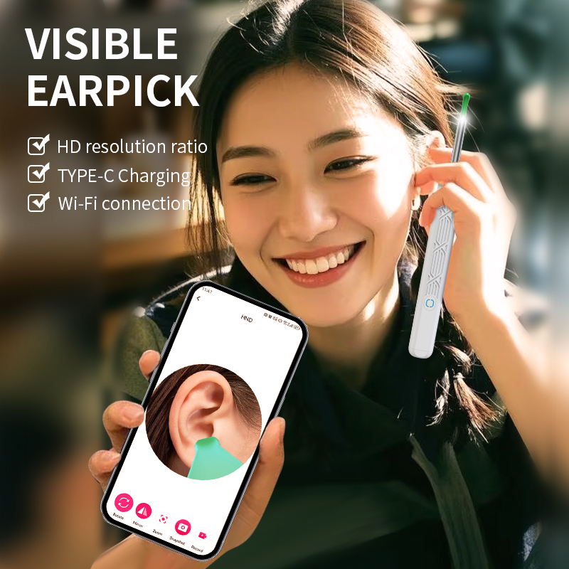 2026년형 무선 스마트 가시화 귀이개 귀지 제거기 H - Iris Photography Led Lighting Pack 리뷰 및 가격